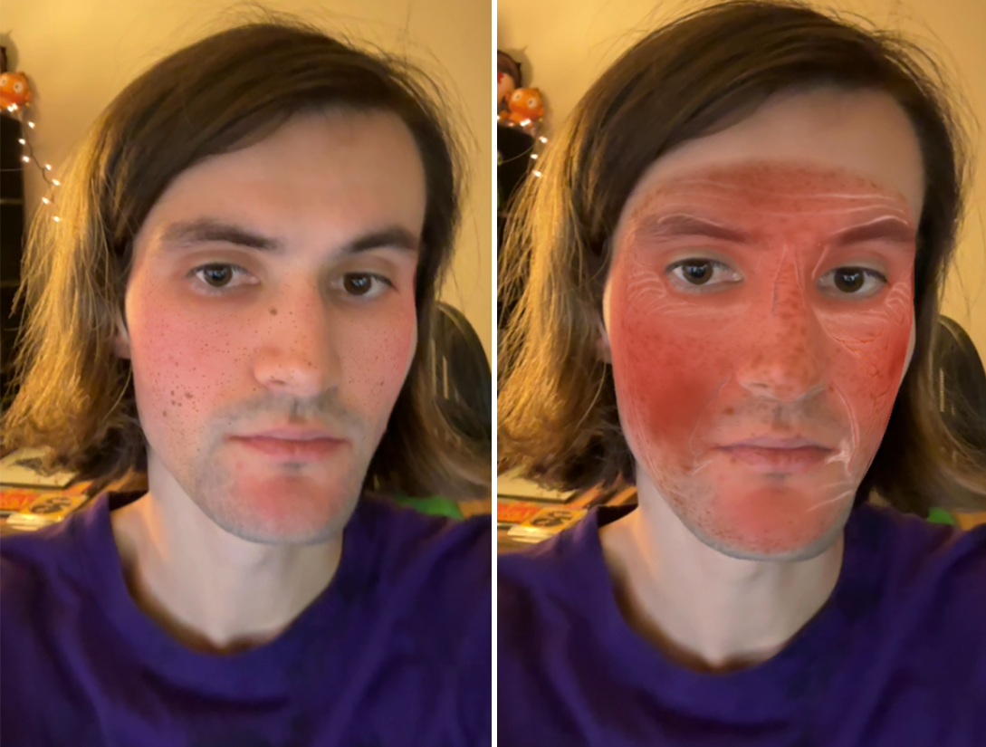 SolAR Run project showing AR skin cancer effects